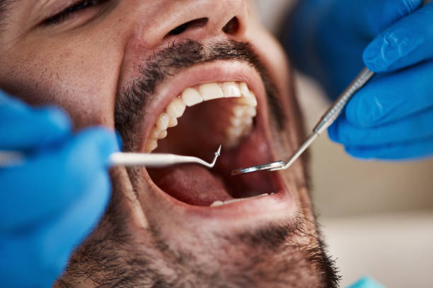 Oral Surgery in Greenfield, IL